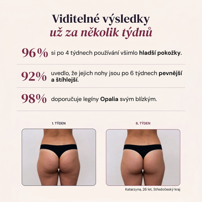 Modelující 3D legíny – Push-Up & Anticellulitní